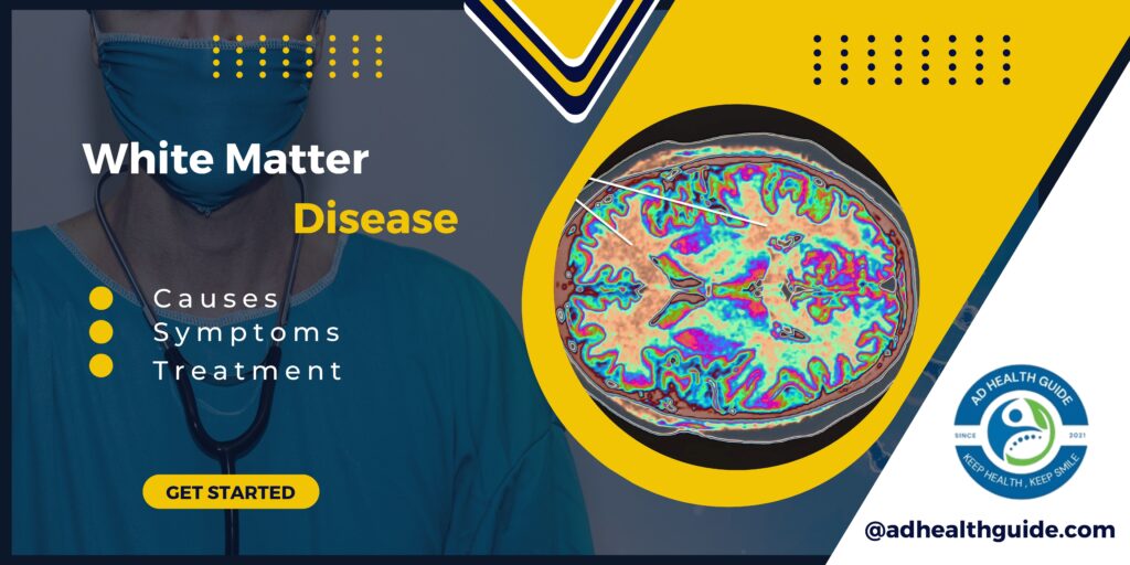 What is White Matter Disease: Symptoms, Causes, Process, and Treatment Options