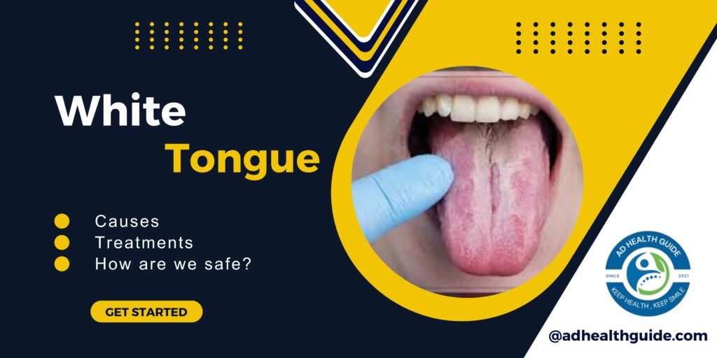 What id White Tongue: Causes, Treatments in 2026