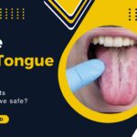 What id White Tongue: Causes, Treatments in 2026